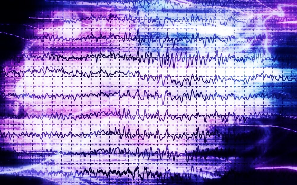 Alcohol and How it Effects Quality Sleep