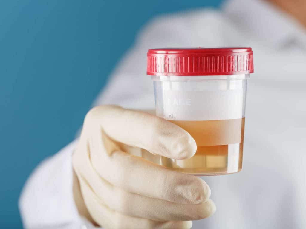 How Long Does Oxycodone Stay in Your System? | AToN Center