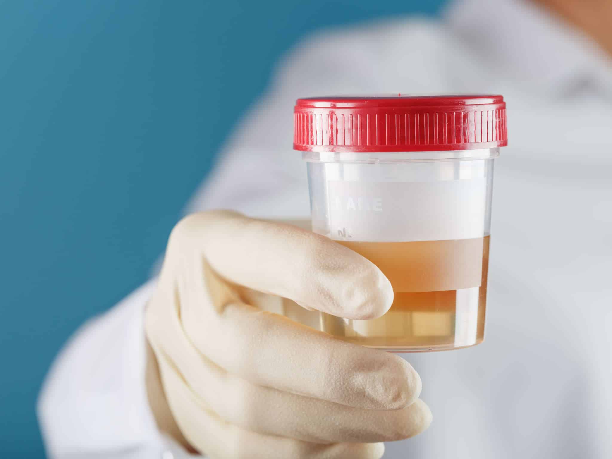 How Long Does Oxycodone Stay in Your System? | AToN Center