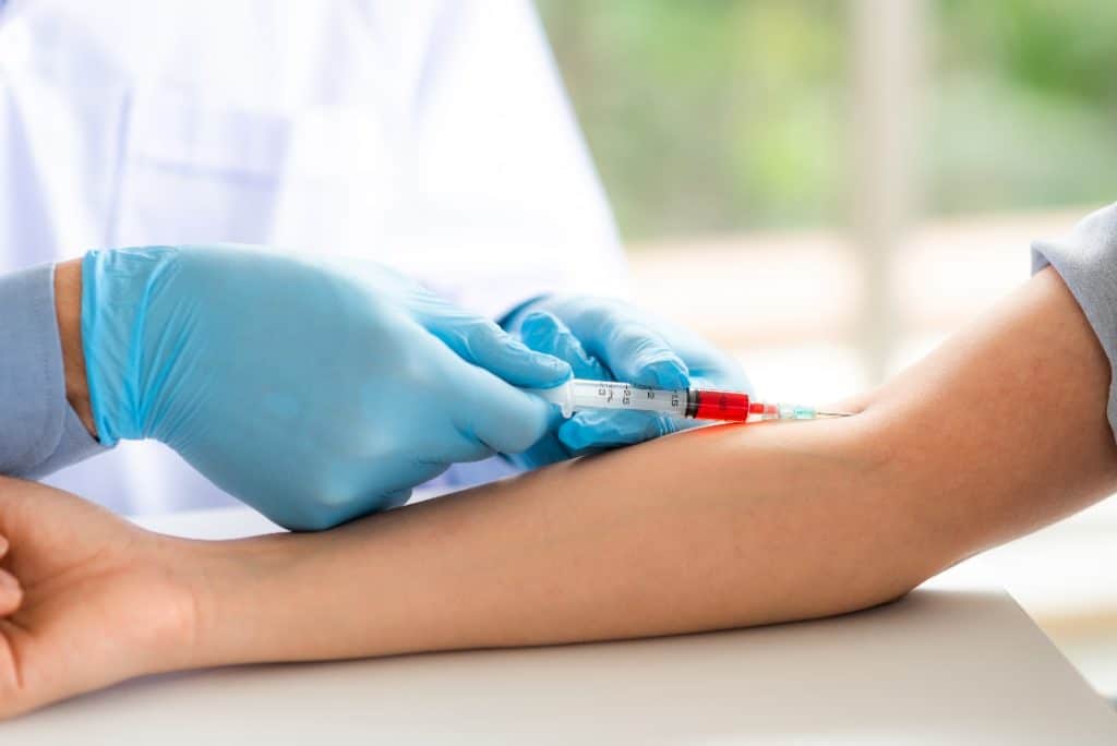 LSD Drug Testing | AToN Center